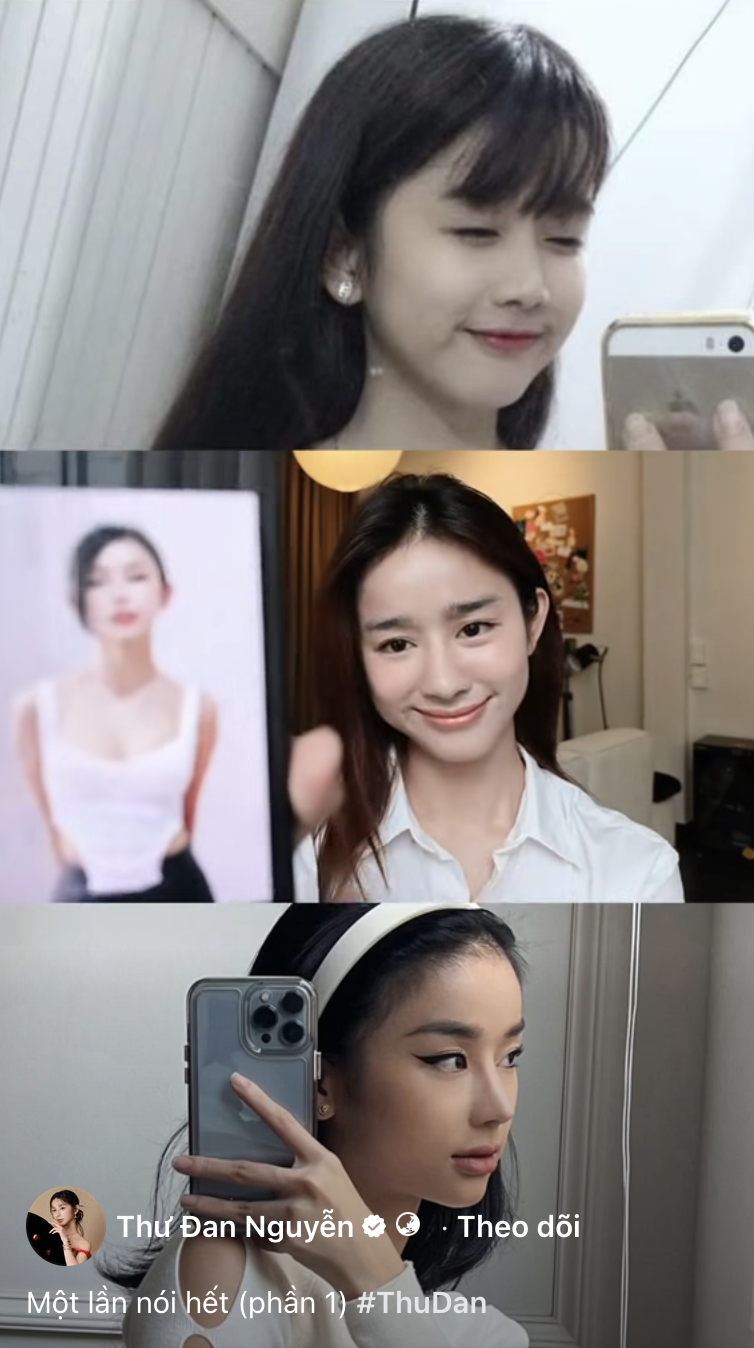 Thư Đan Nguyễn không ngại chia sẻ hình ảnh trong quá khứ, thừa nhận đã sửa mũi, tiêm filler cằm và môi để nâng cấp diện mạo