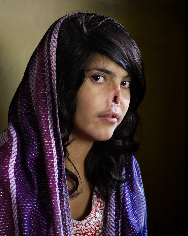 Bibi Aisha, một phụ nữ 18 tuổi trở thành vợ của gã đàn ông Taliban và bị gã này hành hạ. Cô trốn về nhà nhưng bị hắn bắt lại và trừng phạt cô bằng cách cắt hai tai và mũi, để cô lại một mình bên sườn một quả núi, mặc cho máu chảy.