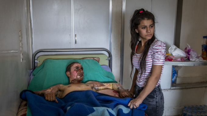 Ivor Prickett ghi lại hình ảnh một chiến bình 18 tuổi thuộc Lực lượng Dân chủ Syria (SDF) bị bỏng nặng sau cuộc xung đột giữa các lực lượng Thổ Nhĩ Kỳ. Người con gái trong bức ảnh là người yêu anh, ban đầu khá sợ hãi nhưng cuối cùng cô đã bước vào, nắm tay Ahmed và nói chuyện động viên anh.
