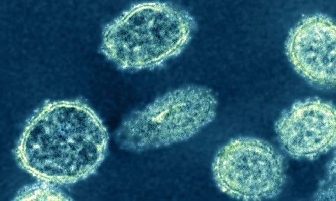 Chủng mới của virus H1N1 đang lây lan mạnh ở Trung Quốc. Ảnh: NIAID.