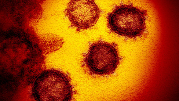   Virus SARS-CoV-2 dưới kính hiển vi - Ảnh: King's College London  