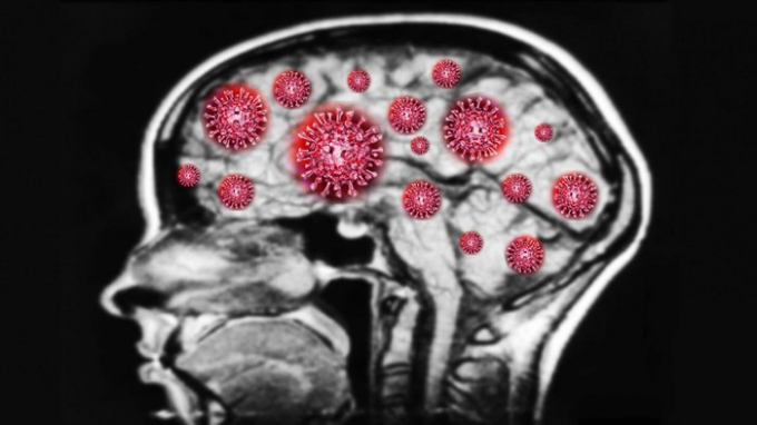 Nghiên cứu mới: Virus Covid-19 có thể xâm nhập vào não