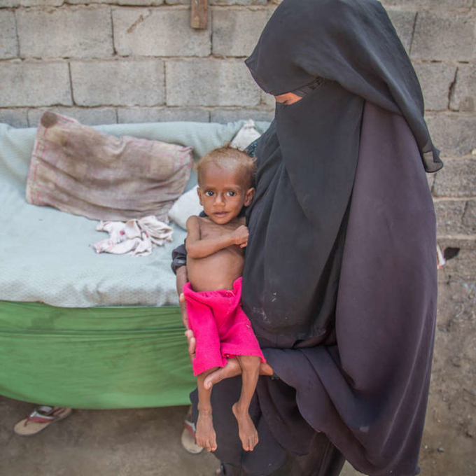 Một bà mẹ người Yemen đang bế đứa con nhỏ suy dinh dưỡng và bị bệnh nhưng không có tiền để đưa đi bệnh viện - Ảnh: Save the Children