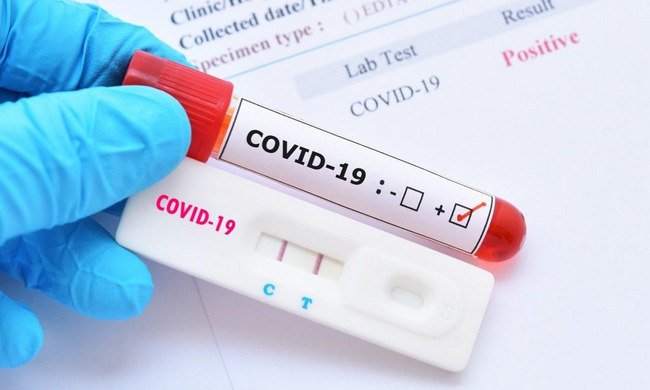 Bộ Y tế chính thức lên tiếng về việc bộ kit test nhanh COVID-19 có giá chênh lệch 