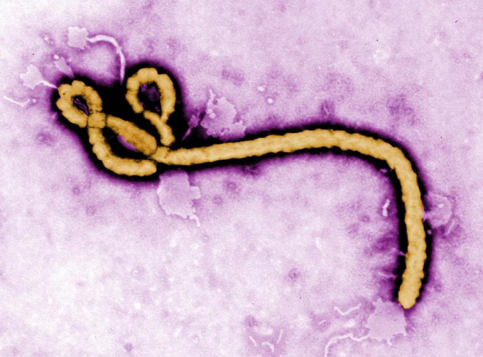 Ebola được phát hiện ẩn náu trong não, tinh dịch, thủy tinh thể của người bệnh dù họ đã được điều trị khỏi. Ảnh: NAIDS.