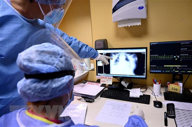   Nhân viên y tế theo dõi hình chụp X-quang phổi của một bệnh nhân COVID-19 tại bệnh viện ở Rome, Italy. (Ảnh: AFP/TTXVN)  
