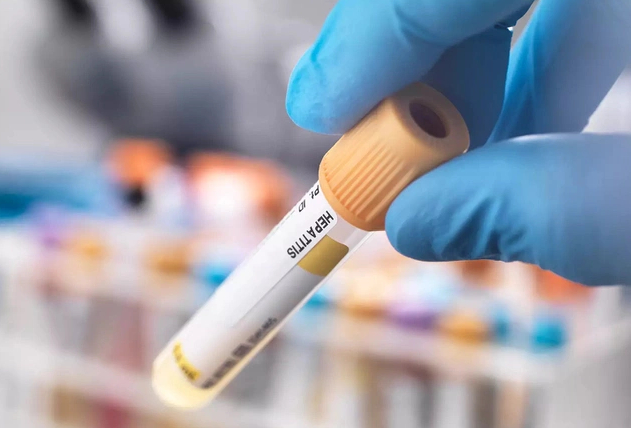 Trung Quốc đưa ra bộ xét nghiệm nhận biết bệnh viêm gan bí ẩn