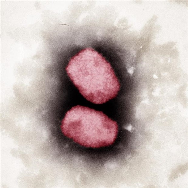 Virus gây bệnh đậu mùa khỉ (ảnh chụp qua kính hiển vi) tại Viện nghiên cứu Robert Koch, Đức. (Ảnh: AFP/TTXVN)
