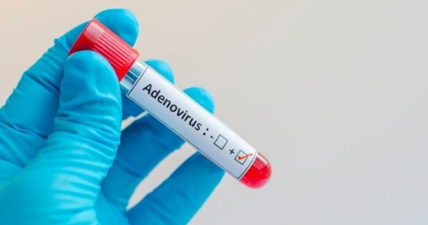 Khi nào cần xét nghiệm Adenovirus?