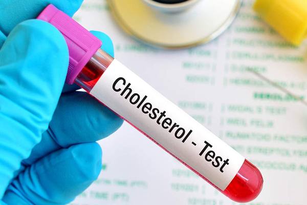 Cholesterol nếu quá cao có thể làm tắc nghẽn mạch máu, tăng nguy cơ mắc các vấn đề về tim hoặc đột quỵ