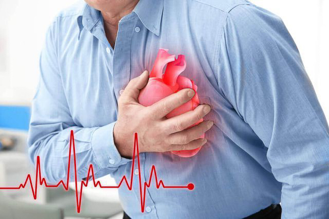 Khoảng 356.000 người mắc bệnh tim tử vong trong một năm vì vi nhựa.