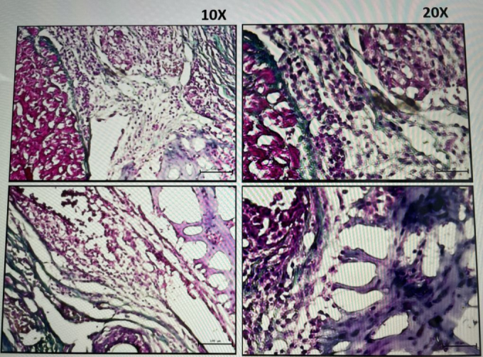 Hình ảnh phóng đại sự liên kết giữa tấm tế bào gốc và cơ tim ở mẫu TB2. Ảnh: NVCC