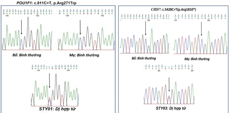 Các biến thể ở các gia đình bệnh nhân mắc bệnh suy tuyến yên