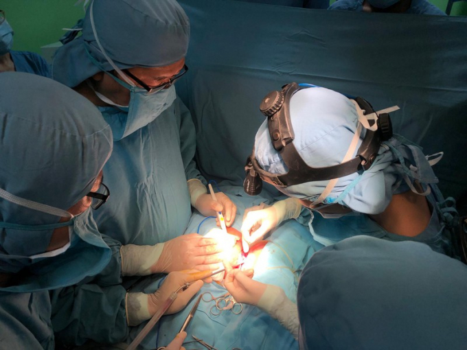 Các bác sĩ trong ê kíp đang phẫu thuật cho hai bé.