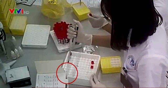 Hàng nghìn que thử HIV, viêm gan B bị cắt đôi trước khi tiến hành xét nghiệm