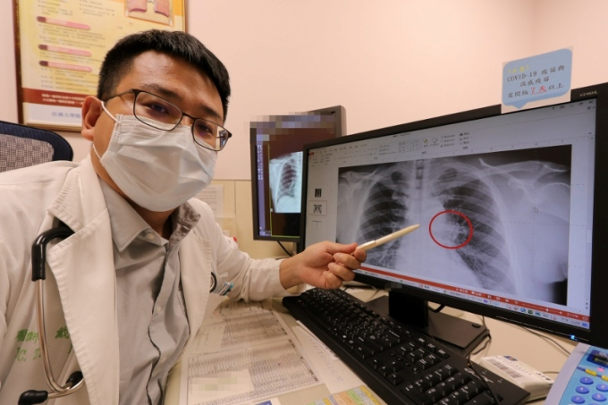   Bác sĩ Dai Fangquan nhắc nhở những triệu chứng ung thư phổi dễ bị nhầm lẫn (Ảnh bệnh viện cung cấp)  