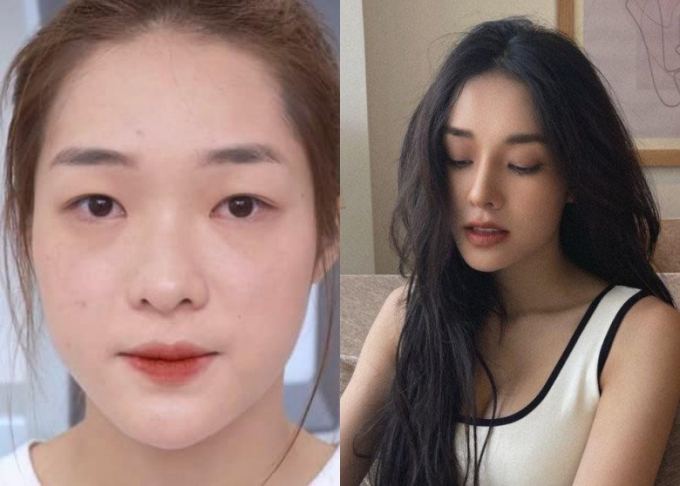 Hồng Hạnh trước và sau khi phẫu thuật thẩm mỹ