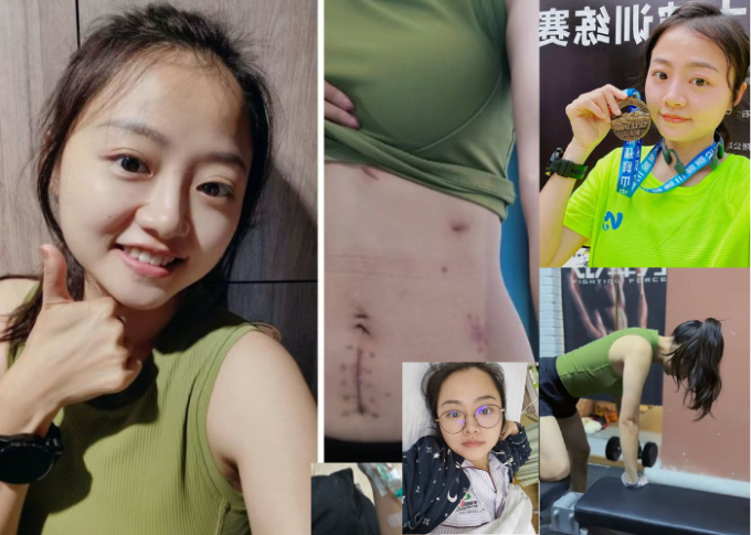   Cô Trương đang tích cực thay đổi lối sống và hy vọng người trẻ rút kinh nghiệm từ trường hợp của mình (Ảnh nhân vật đăng tải)  