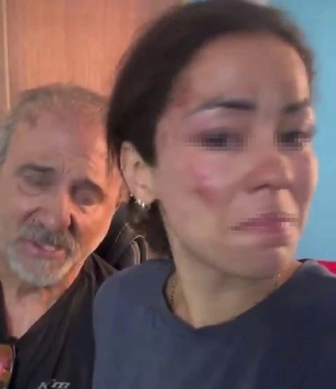 Cặp đôi khách du lịch đến từ Tây Ban Nha bị tấn công trong thời gian nghỉ tại lều 