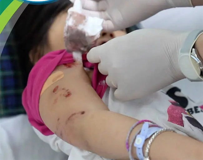 Hình ảnh bé gái bị chó dữ tấn công để lại nhiều vết thương trên cánh tay