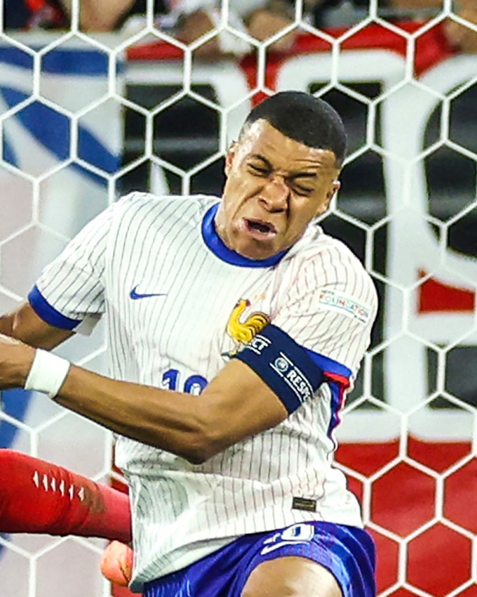 Mbappe trước đó bị gãy mũi sau pha va chạm