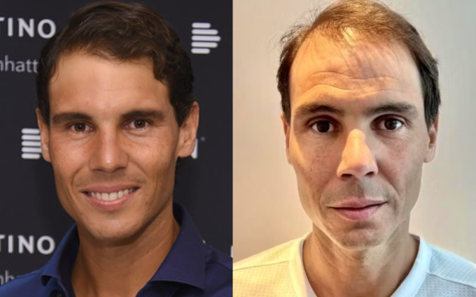 Nhiều người cho rằng Rafael Nadal trông già hơn khoảng 10 tuổi trong ảnh thẻ