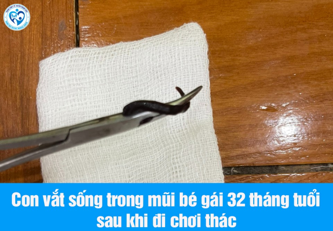 Thấy bé gái có biểu hiện lạ sau nửa tháng tắm thác nước, bố mẹ cho nhập viện thì phát hiện thứ đáng sợ trong mũi con