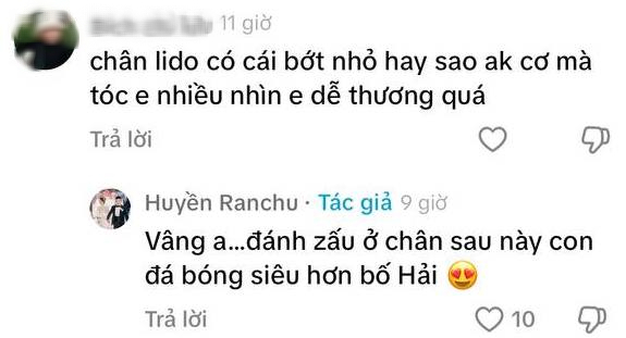 Chu Thanh Huyền nói về vết bớt trên chân của con trai