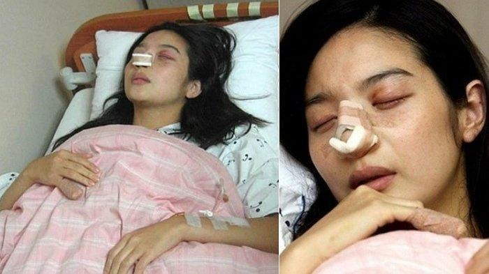 Nhìn Lee Min Young nằm trên giường bệnh, ai cũng xót xa. Ảnh: Pinterest