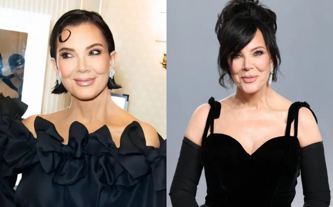 Ca phẫu thuật da mặt trị giá 2,6 tỷ đồng xuống cấp chỉ sau 1 năm. Ảnh: Page Six