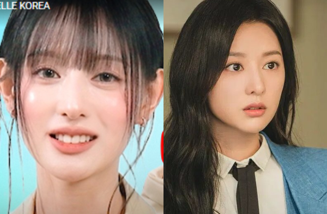 Nhìn vào chiếc cằm nhọn hoắt, gương mặt gầy gò của Kim Ji Won, không ít người nghi vấn cô đã đi hút mỡ mặt và gọt cằm nên dẫn đến biến chứng thẩm mỹ. Ảnh: X.