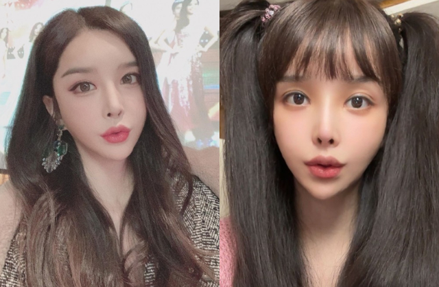 Do lạm dụng dao kéo, gương mặt của Harisu hiện tại trông như mặt rắn, đơ cứng. Ảnh: Sina. 