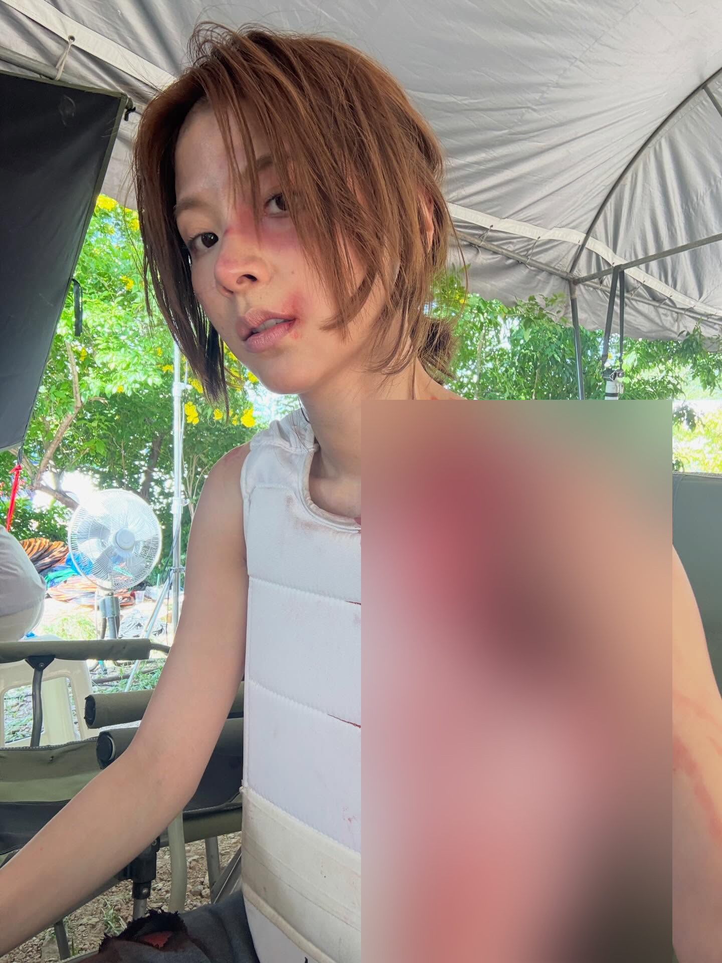 Baifern bỗng dưng xuất hiện với hình ảnh tiều tụy không tin nổi. Chưa hết, công chúng còn đổ dồn sự chú ý vào hàng loạt vết thâm tím trên khắp cơ thể và khuôn mặt nữ nghệ sĩ 9X. Ảnh: Sanook