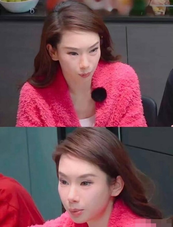 Năm 2025, cô bị biến dạng gương mặt vì tiêm botox quá lố. Đôi mắt xếch kỳ lạ, gương mặt sưng phù của nữ diễn viên gây bàn tán xôn xao trên MXH. Nhan sắc của cô bị ví như 