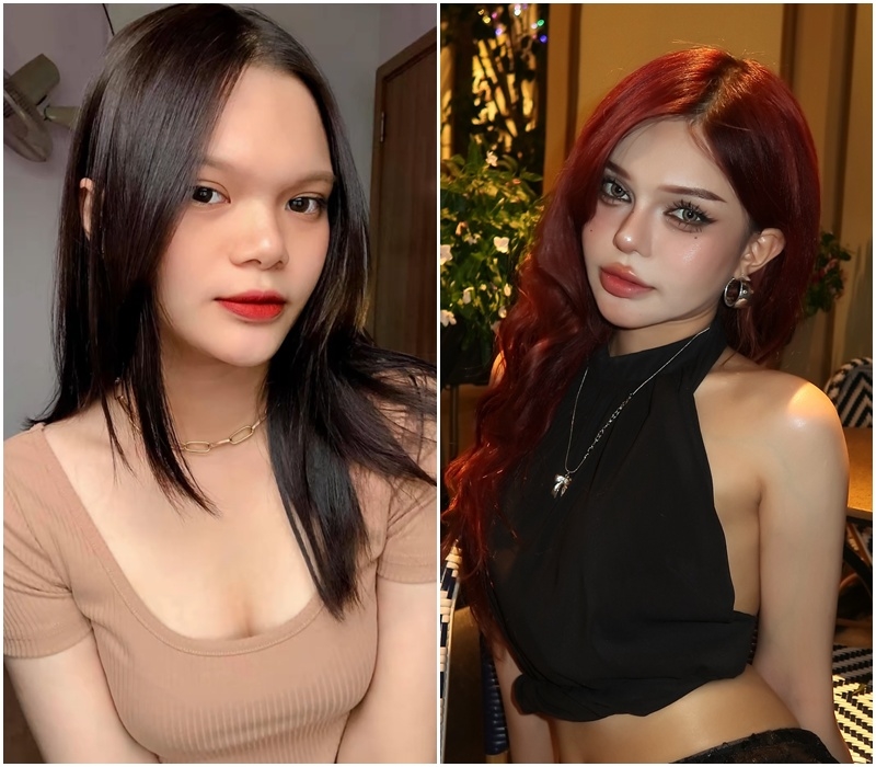 Cô nàng trải qua nhiều lần phẫu thuật thẩm mỹ.