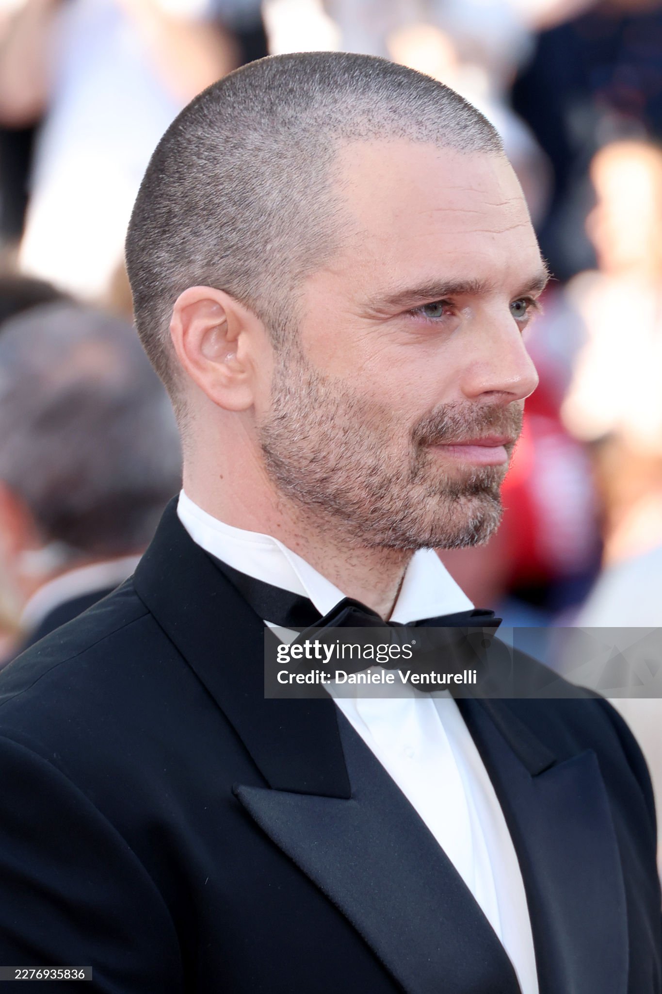 Khán giả vô cùng bất ngờ trước diện mạo lạ lẫm của anh. Ảnh: Getty Images