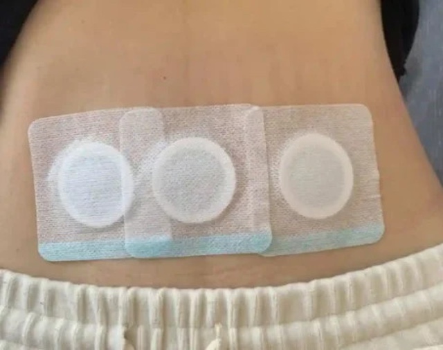 Không đặt hạt tiêu lên rốn quá lâu, tốt nhất là khoảng 30 phút (Ảnh minh họa)