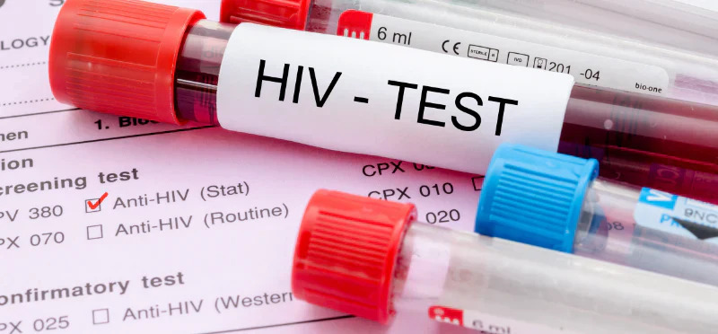 Nữ giáo viên 48 tuổi đột nhiên phát hiện nhiễm HIV khi khám sức khỏe tại cơ quan (Ảnh minh họa)