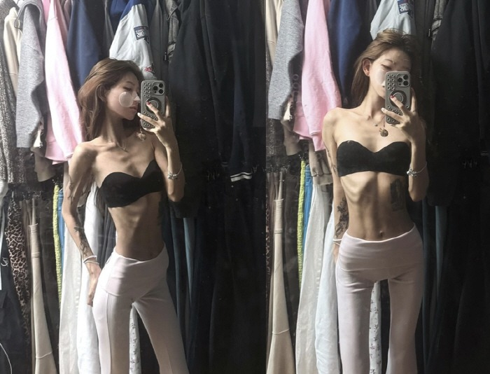 Hồi đầu năm nay, cô từng khiến công chúng phát hoảng khi lộ diện với thân hình tiều tụy chỉ còn “da bọc xương” đúng nghĩa. Ảnh: Nate