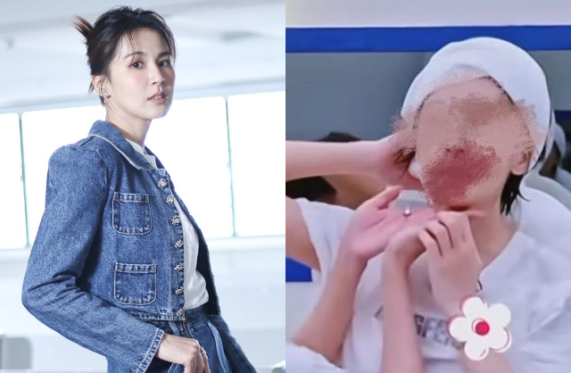 Người gặp vấn đề sức khỏe nghiêm trọng nhất là Tăng Bái Từ. Cô được chẩn đoán mắc viêm họng cấp tính và viêm mũi, sau đó còn đột ngột bị chảy cam lúc luyện tập, nghi bị ngộ độc chất gây ung thư Formaldehyde. Ảnh: Weibo.
