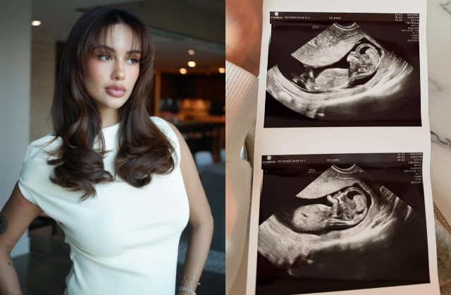 Cuối tháng 4, Celeste Cortesi thông báo đã mang thai con đầu lòng với bạn trai Jonathan Sterling. Ảnh: Instagram.