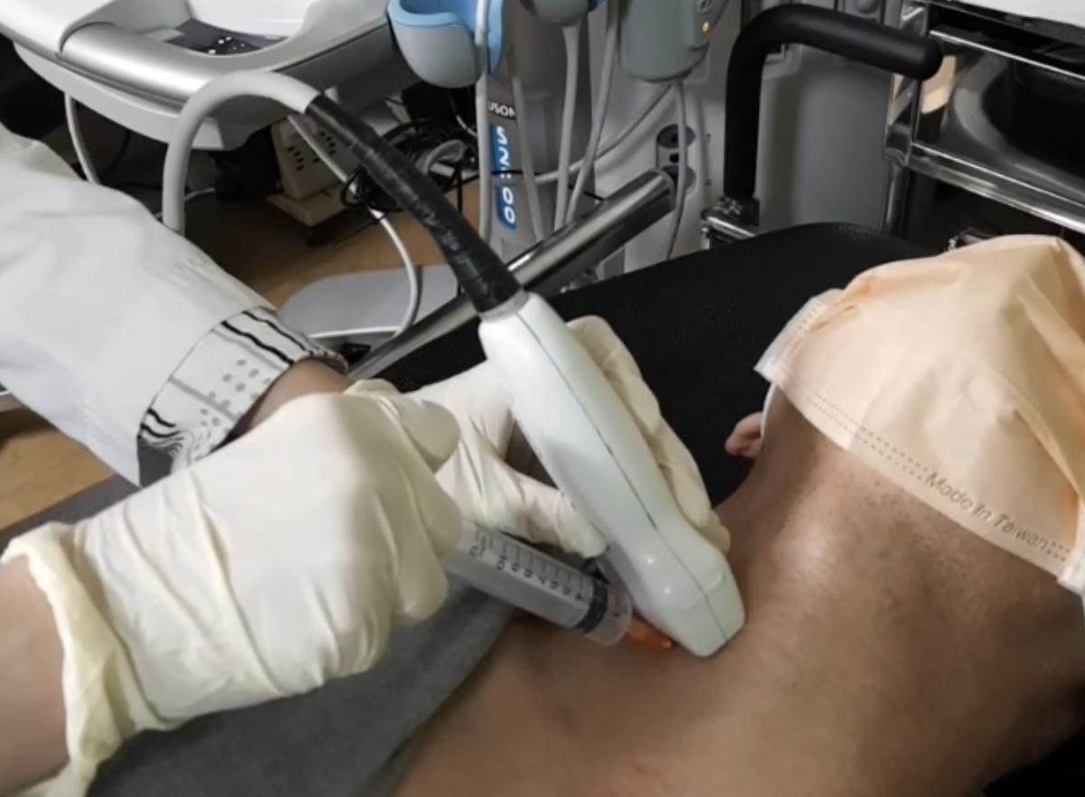 Sau khi làm sinh thiết, bác sĩ phát hiện Tiểu Bũ mắc ung thư tuyến giáp thể nhú giai đoạn sớm (Ảnh minh họa)