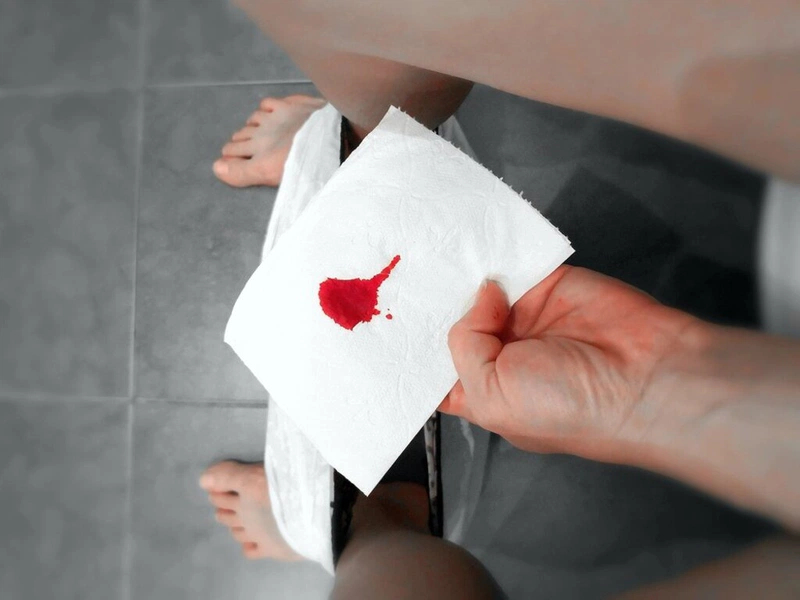 Nếu thấy có bất thường về màu, mùi hay lẫn máu trong phân, xin đừng chủ quan (Ảnh minh họa)