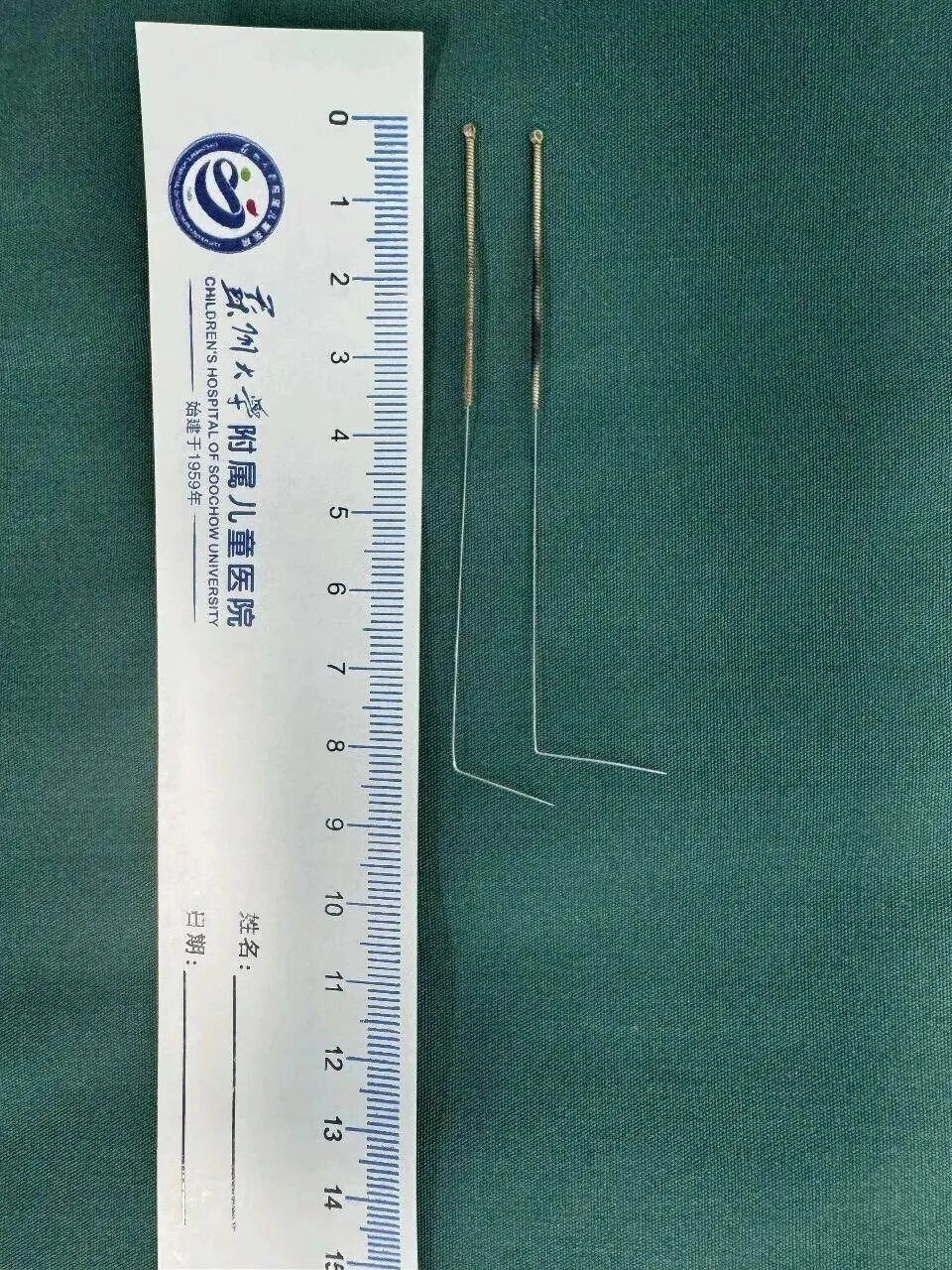 Hình ảnh 2 chiếc kim gỉ sét được lấy ra sau ca phẫu thuật Ảnh từ BV)