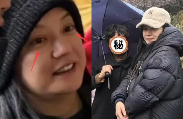 Gương mặt mộc lộ rõ dấu hiệu lão hóa, sưng phồng của Triệu Vy. Ảnh: Sina.