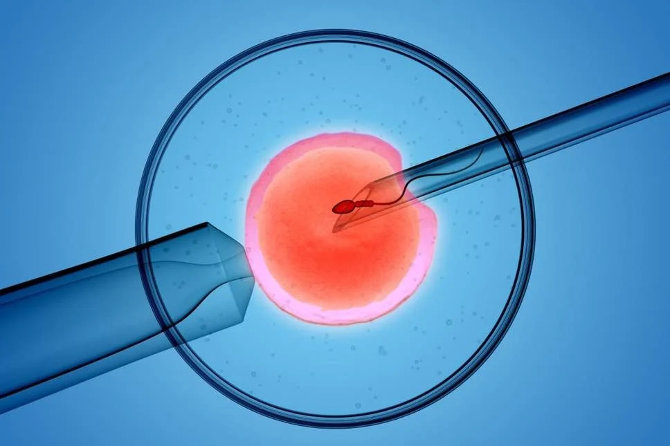 IVF là