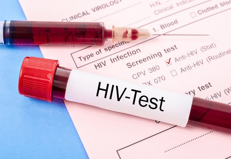 Chương trình Phối hợp của Liên hợp quốc về HIV/AIDS (UNAIDS) đưa ra cảnh báo nguy cơ đại dịch bùng phát trở lại trên phạm vi toàn cầu