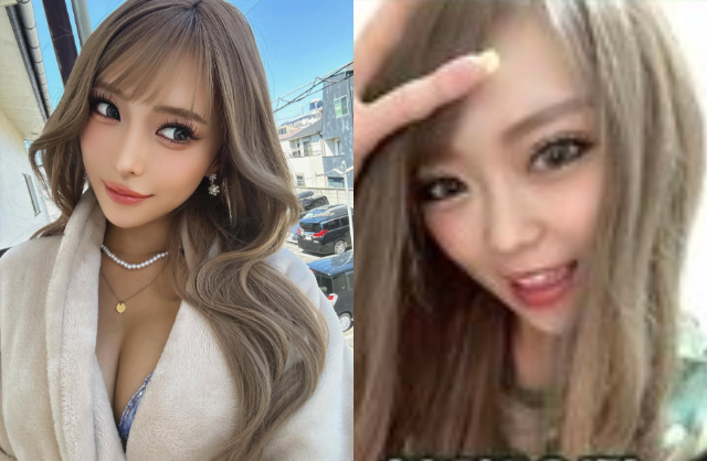 Hình ảnh trước và sau khi