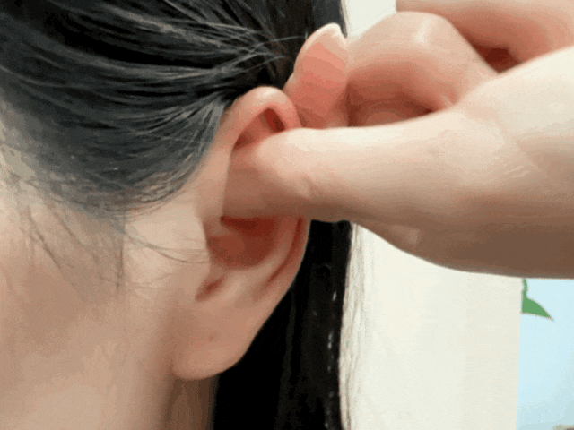 Trong số những người sống thọ trăm tuổi, 85% có thứ này ở tai
