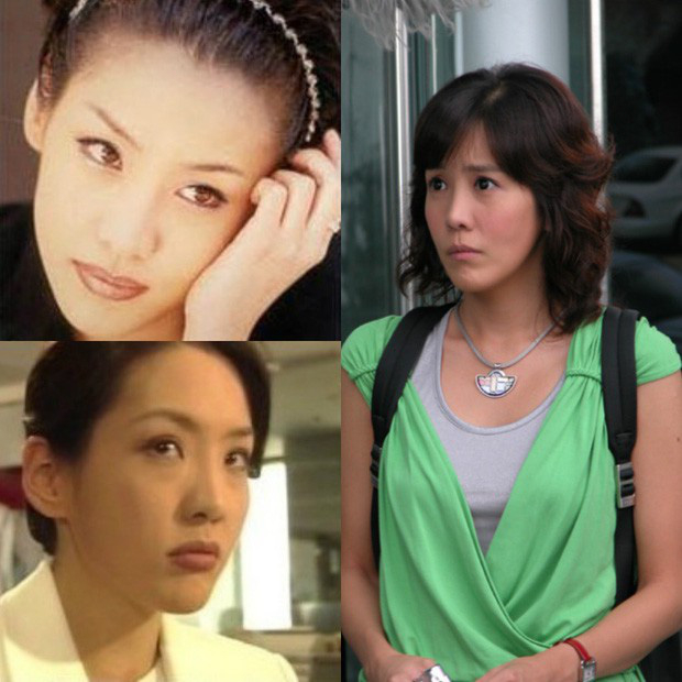 Kim Jung Eun “dao kéo” hỏng hết mặt. Nhiều khán giả không khỏi tiếc nuối khi ngắm nhìn nhan sắc trước khi phẫu thuật thẩm mỹ của nữ diễn viên (ảnh trái). Ảnh: X